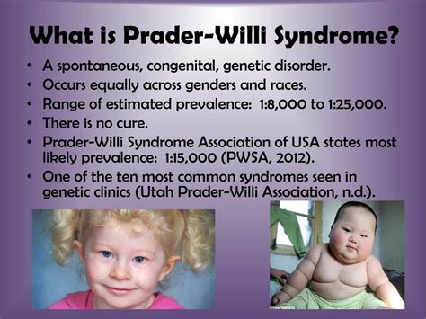 prada williams syndrome|can prader willi syndrome be inherited.